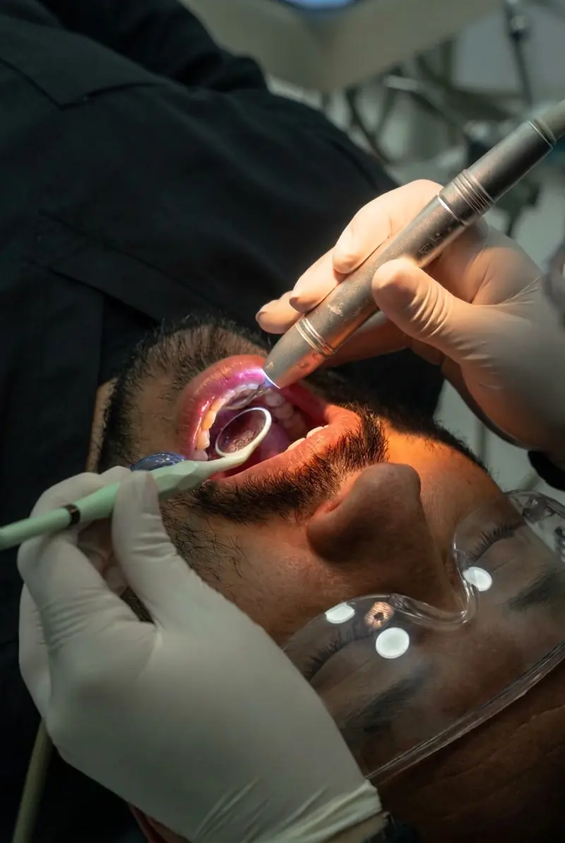 Caso clínico de Periodoncia en Ozono Dental Group